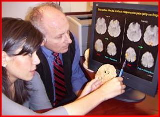 MBRS reviewing brain